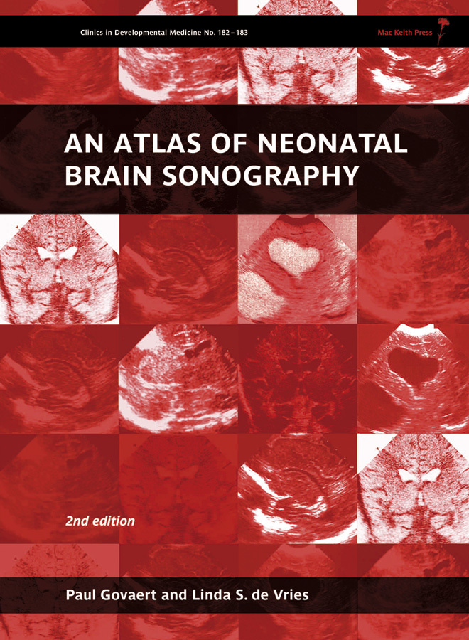 Read An Atlas of Neonatal Brain Sonography, 2nd Edition Online by Paul