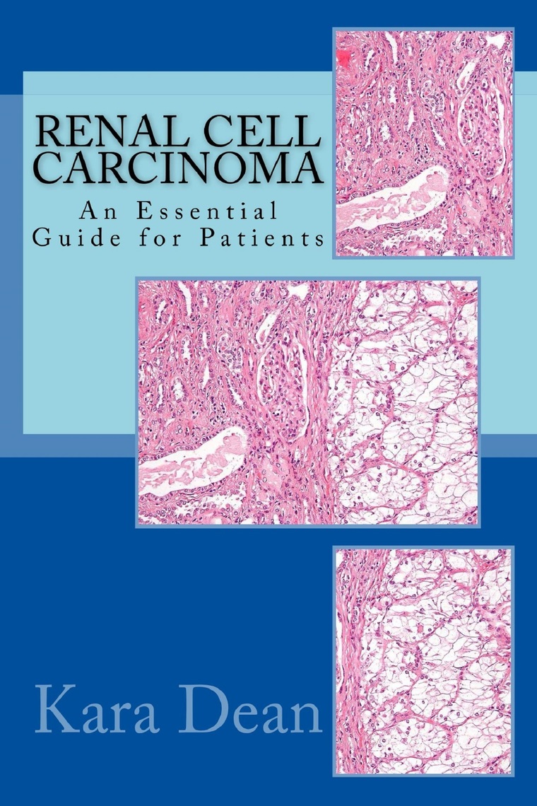 Read Renal Cell Carcinoma An Essential Guide for Patients