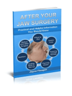 After Your Jaw Surgery: Practical and Helpful Information You Should Know