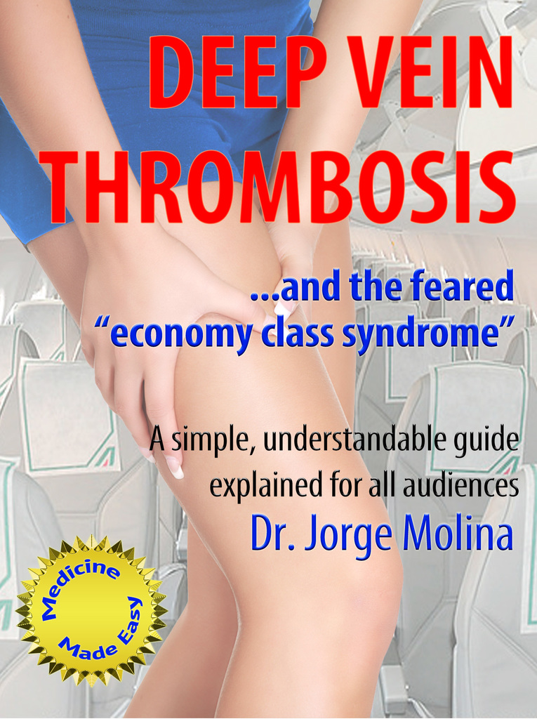 Deep Vein Thrombosis by Molina Book Read Online