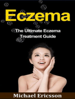Eczema: The Ultimate Eczema Treatment Guide