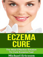 Eczema Cure: The Most Effective Solution to Cure Eczema Fast