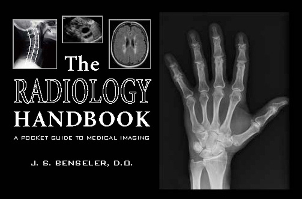 The Radiology Handbook by J. S. Benseler Book Read Online