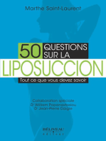 50 questions sur la liposuccion