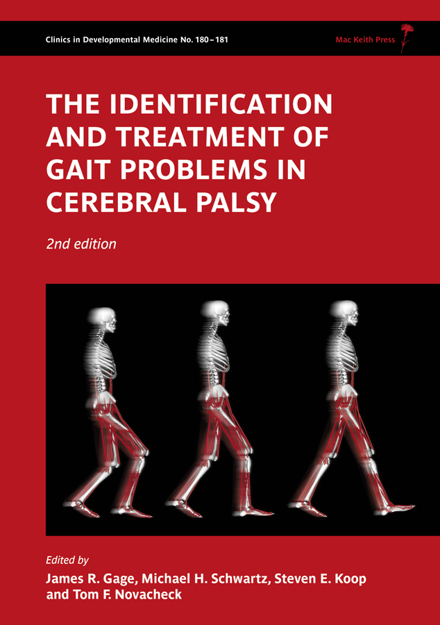 The Identification and Treatment of Gait Problems in Cerebral Palsy ...