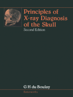 Principles of X-Ray Diagnosis of the Skull