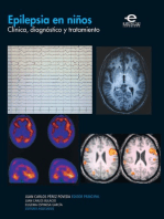 Epilepsia en niños: Clínica, diagnóstico y tratamiento