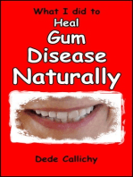 What I did to Heal Gum Disease Naturally