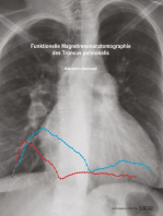 Funktionelle Magnetresonanztomographie des Truncus pulmonalis