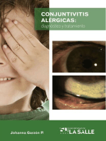 Conjuntivitis alérgicas: Diagnóstico y tratamiento