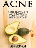 Acne: Acne Treatment: Acne Removal: Acne Remedies For Clear Skin