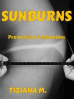 Sunburns: Prevention & Remedies