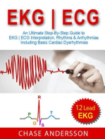EKG | ECG: An Ultimate Step-By-Step Guide to 12-Lead EKG | ECG Interpretation, Rhythms & Arrhythmias Including Basic Cardiac Dysrhythmias