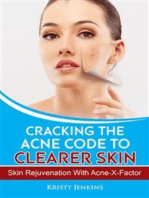 Cracking the Acne Code to Clearer Skin