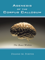 Agenesis of the Corpus Callosum: The Beast Within