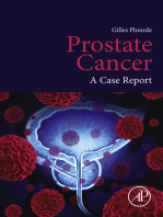 Prostate Cancer: A Case Report