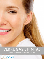 Verrugas e pintas: Como remover de forma natural