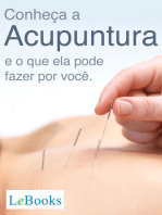 Conheça a acupuntura e o que ela pode fazer por você