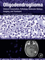 Oligodendroglioma: Clinical Presentation, Pathology, Molecular Biology, Imaging, and Treatment