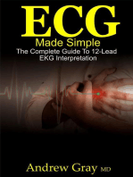ECG Made Simple