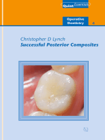 Successful Posterior Composites