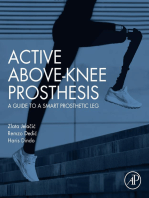 Active Above-Knee Prosthesis: A Guide to a Smart Prosthetic Leg