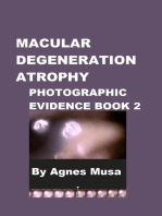 Macular Degeneration Atrophy, Photographic Evidence Book 2