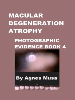 Macular Degeneration Atrophy, Photographic Evidence Book 4