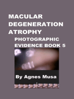 Macular Degeneration Atrophy, Photographic Evidence Book 5