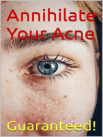 Annihilate Your Acne: How to Get Rid of Acne and Create Beautiful, Clear Skin; Your Easy, Proven Plan to Get Rid of Acne Fast