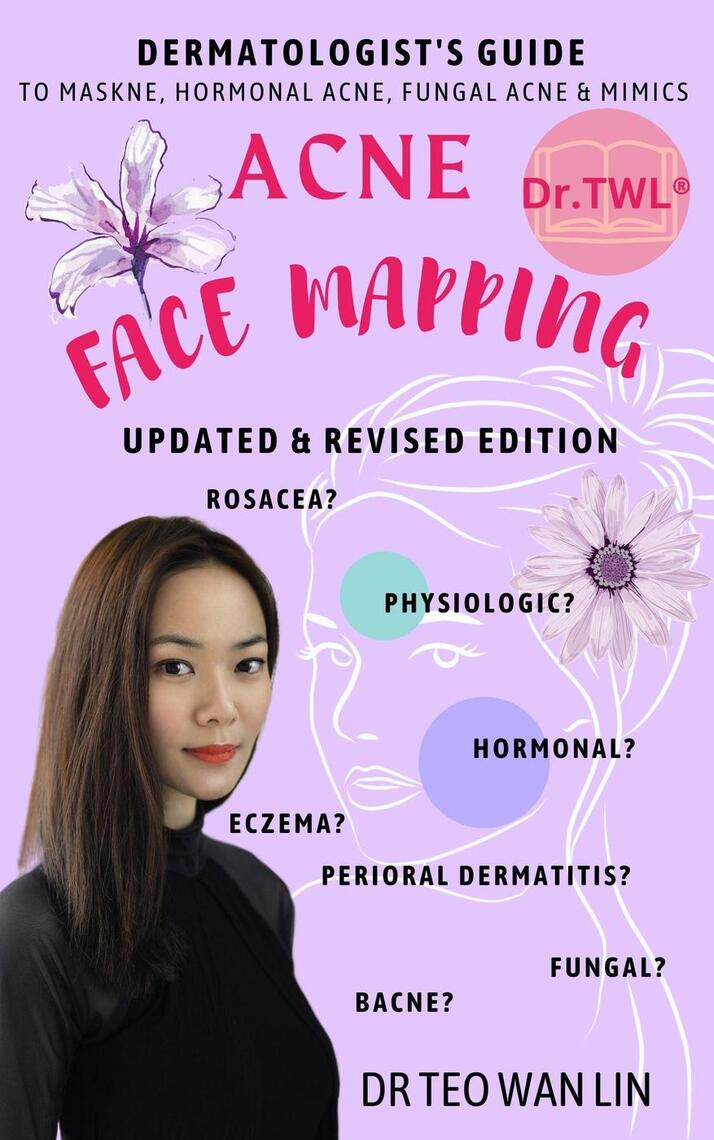 Acne Face Mapping: A Dermatologist’s Specialist Module on Adult ...