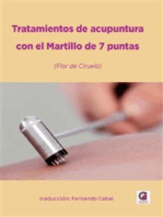 Tratamientos de acupuntura con el Martillo de 7 puntas