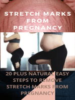 20 PLUS EASY STEPS TO REMOVE STRETCH MARKS FROM PREGNANNT