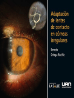 Adaptación de lentes de contacto en córneas irregulares