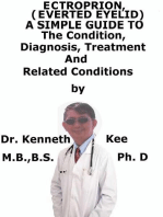 Ectropion, (Everted Eyelid) A Simple Guide To The Condition, Diagnosis, Treatment And Related Conditions