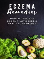 Eczema Remedies | How to Relieve Eczema With Diet & Natural Remedies