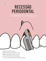 Recessão Periodontal: Tratamento Cirúrgico