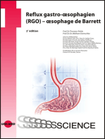 Reflux gastro-oesophagien (RGO) - oesophage de Barrett