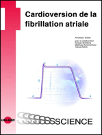 Cardioversion de la fibrillation atriale