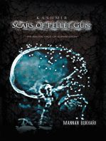 Kashmir - Scars of Pellet Gun: The Brutal Face of Suppression