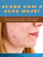 Acabe com a acne hoje!