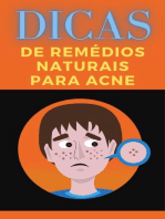 Dicas de Remédios Naturais Para Acne