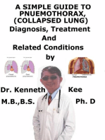 A Simple Guide to Pneumothorax (Collapsed Lungs), Diagnosis, Treatment and Related Conditions