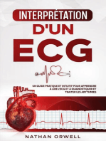 Interprétation d'un ECG: Un Guide Pratique et Intuitif pour Apprendre à Lire un ECG et pour Diagnostiquer et Traiter les Arythmies