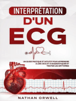 Interprétation d'un ECG