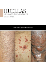 Huellas: Lesiones elementales de la piel