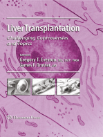 Liver Transplantation: Challenging Controversies and Topics