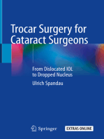 Trocar Surgery for Cataract Surgeons: From Dislocated IOL to Dropped Nucleus