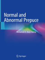 Normal and Abnormal Prepuce