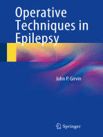 Operative Techniques in Epilepsy